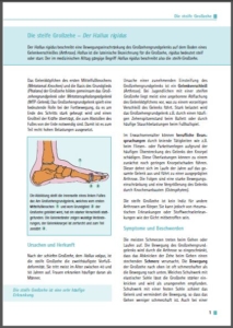 Kapitel zum Hallux Rigidus